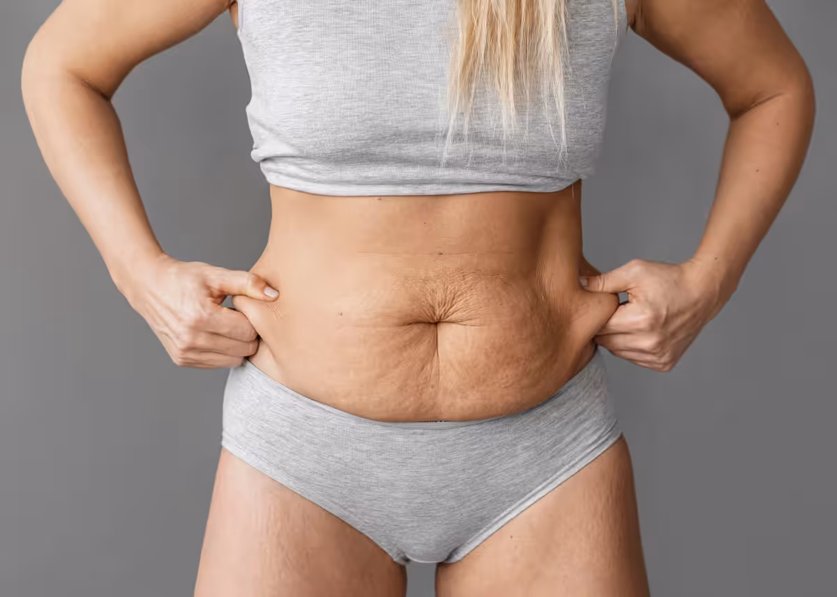 Endoláser Anticelulitis: Resultados en una Sola Sesión vs. Mesoterapia Clásica