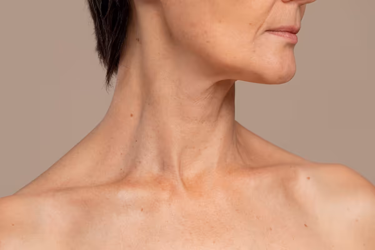 Rejuvenecimiento de Cuello y Escote: Tratamientos Efectivos - Artículo sobre medicina estética en Madrid