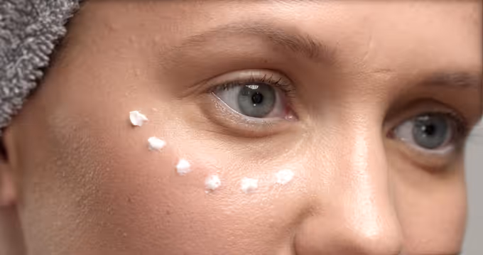 Ojeras: Tipos y Tratamientos Efectivos Según Cada Caso